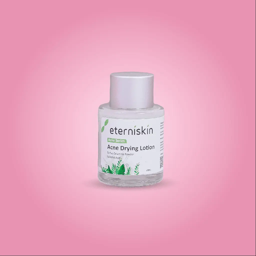 Acne Drying Lotion
